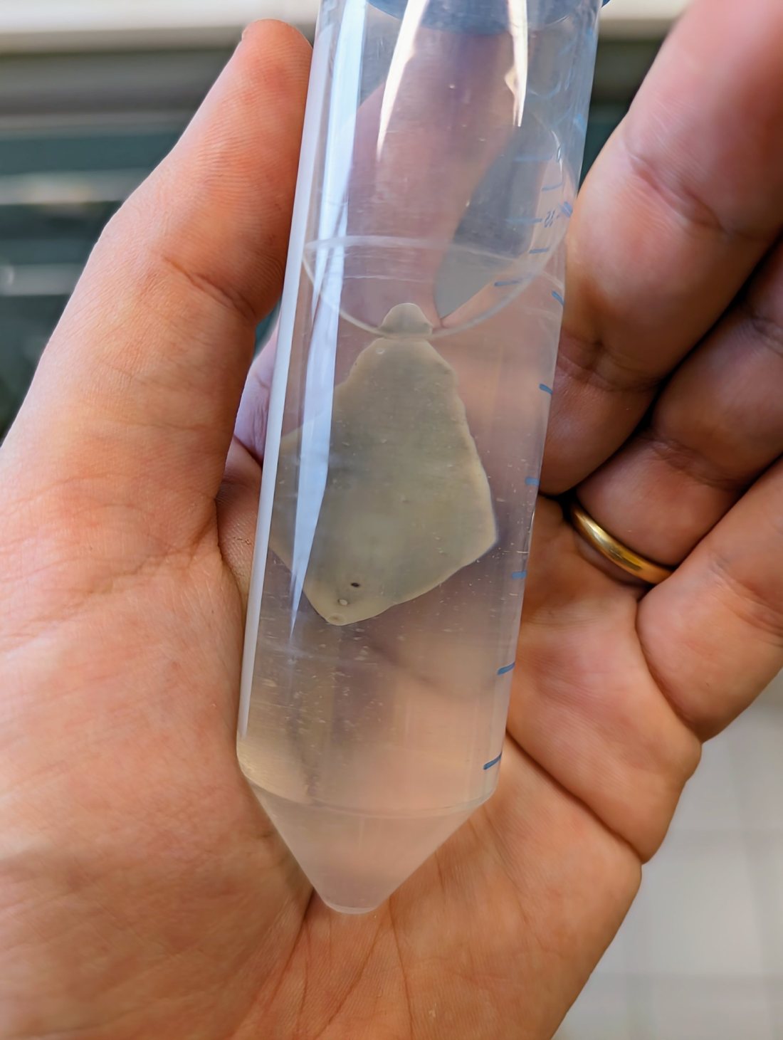 Fascioloides magna in una provetta tenuta in mano